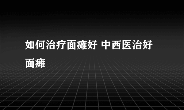 如何治疗面瘫好 中西医治好面瘫