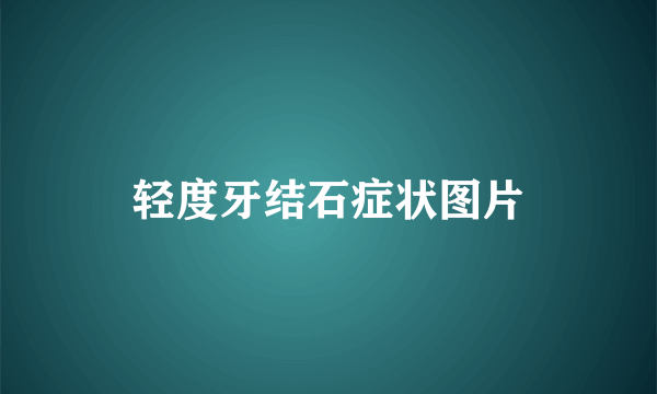 轻度牙结石症状图片