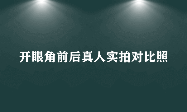 开眼角前后真人实拍对比照