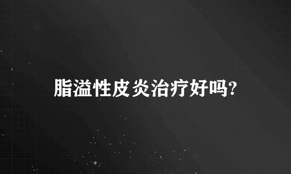 脂溢性皮炎治疗好吗?